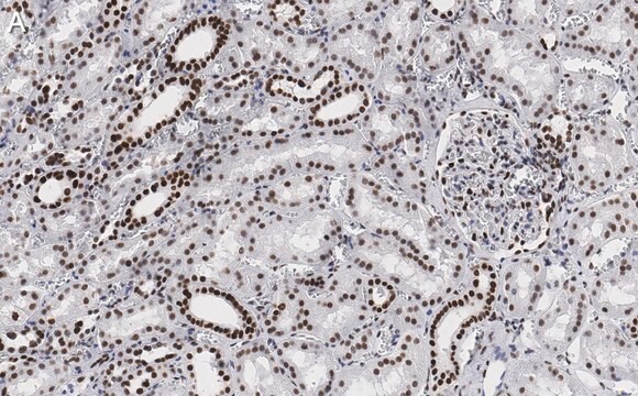 Anti-53BP1 Antibody, clone 1H16 ZooMAb&#174; Rabbit Monoclonal recombinant, expressed in HEK 293 cells