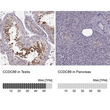 Anty-CCDC89 Prestige Antibodies&#174; Powered by Atlas Antibodies, affinity isolated antibody