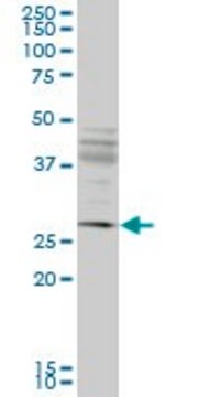 Monoclonal Anti-IFT57 antibody produced in mouse clone 1G8, purified immunoglobulin, buffered aqueous solution