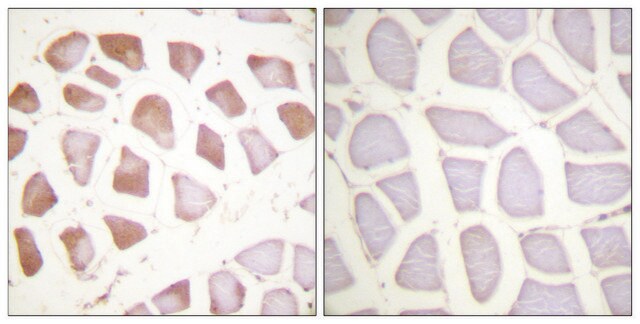 抗TNNI3 ウサギ宿主抗体 affinity isolated antibody