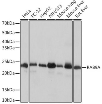 Anti-RAB9A Antibody, clone 7O1G4, Rabbit Monoclonal