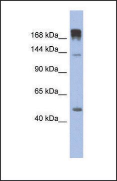 抗 SLIT3，（N-末端） 兔抗 affinity isolated antibody