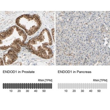 Anti-ENDOD1 antibody produced in rabbit Prestige Antibodies&#174; Powered by Atlas Antibodies, affinity isolated antibody, buffered aqueous glycerol solution