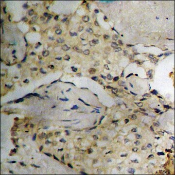 Anti-phospho-Synuclein-&#945; (pTyr136) antibody produced in rabbit affinity isolated antibody