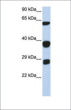 Anti-SNRPB antibody produced in rabbit affinity isolated antibody