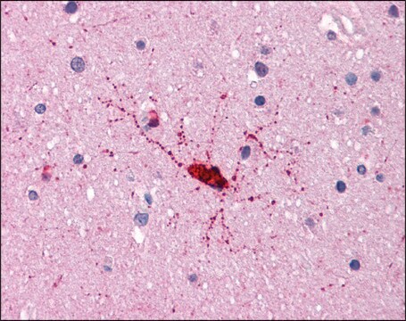 Anti-BCAS1 / NABC1 antibody produced in rabbit affinity isolated antibody