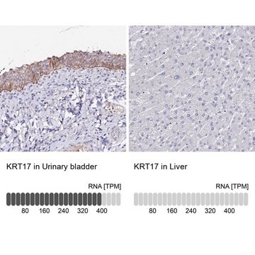 抗KRT17抗体 ウサギ宿主抗体 Prestige Antibodies&#174; Powered by Atlas Antibodies, affinity isolated antibody, buffered aqueous glycerol solution