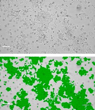 HCI-EC-23 Human Endometrial Cancer Cell Line