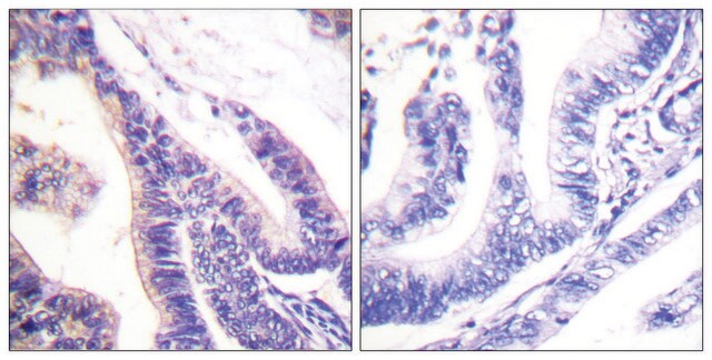 Anti-p70 S6 Kinase antibody produced in rabbit affinity isolated antibody