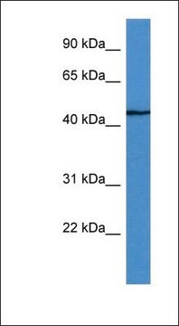 Anti-FBXW4 antibody produced in rabbit affinity isolated antibody