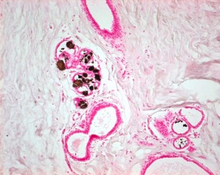 银染试剂盒，依据von Kossa for the detection of microcalcification