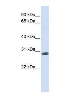 Anti-YIPF6 antibody produced in rabbit affinity isolated antibody