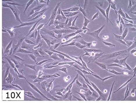 SF8628 Ludzka linia komórkowa DIPG H3.3-K27M SF8628 pediatric diffuse intrinsic pontine glioma (DIPG) cell line harbors the histone H3.3 Lys 27-to-methionine (K27M) mutation and can support research and drug development efforts targeting DIPG.