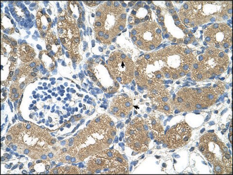 Anti-ADH4 antibody produced in rabbit IgG fraction of antiserum