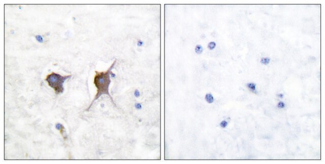 Anti-BAX antibody produced in rabbit affinity isolated antibody