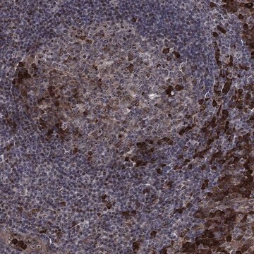 Anti-Vhl Antibody Produced In Rabbit Prestige Antibodies&#174; Powered by Atlas Antibodies, affinity isolated antibody, buffered aqueous glycerol solution