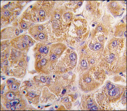 Anti-PYGM (center) antibody produced in rabbit Ig fraction of antiserum, buffered aqueous solution