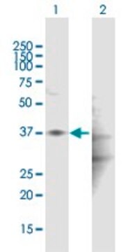 Anti-HAPLN1 antibody produced in mouse purified immunoglobulin, buffered aqueous solution