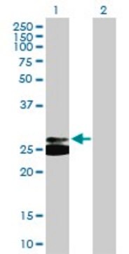 Anti-TREM1 antibody produced in mouse purified immunoglobulin, buffered aqueous solution