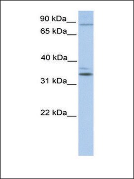 Anti-NPAS2 (AB2) antibody produced in rabbit affinity isolated antibody