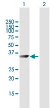 Anti-CRYM antibody produced in mouse purified immunoglobulin, buffered aqueous solution