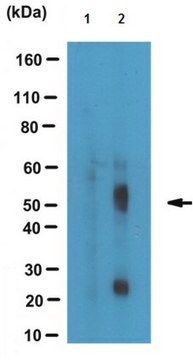 Anti-phospho Tau (Thr181), clone 1E7 Antibody clone 1E7, from mouse, purified by affinity chromatography