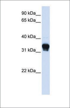 抗CSNK1A1抗体 ウサギ宿主抗体 affinity isolated antibody