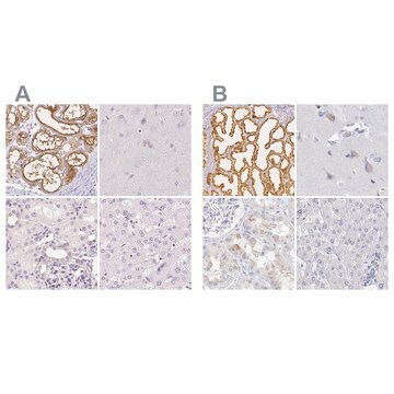 Anty-CSN1S1 Prestige Antibodies&#174; Powered by Atlas Antibodies, affinity isolated antibody