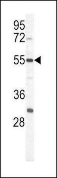 ANTI-PKM1 (C-TERM L398) antibody produced in rabbit purified immunoglobulin, buffered aqueous solution