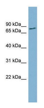 Anti-FURIN (N-terminal) antibody produced in rabbit affinity isolated antibody