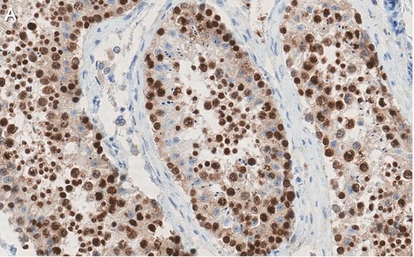 Anti-REST Antibody, clone 2E3 ZooMAb&#174; Rabbit Monoclonal recombinant, expressed in HEK 293 cells