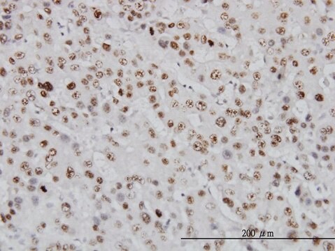 Monoclonal Anti-TOP1 antibody produced in mouse clone 1A1, purified immunoglobulin, buffered aqueous solution