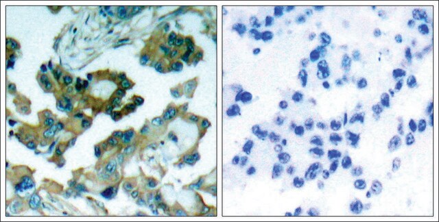 Anti-PTK2 (Ab-861) antibody produced in rabbit affinity isolated antibody