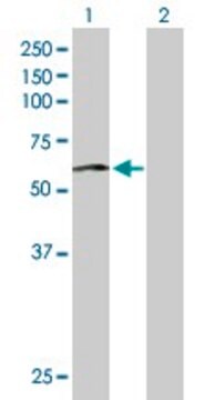 Anti-PHACS antibody produced in mouse purified immunoglobulin, buffered aqueous solution