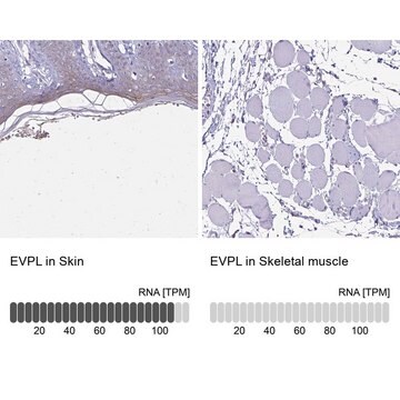 Anti-EVPL antibody produced in rabbit Prestige Antibodies&#174; Powered by Atlas Antibodies, affinity isolated antibody, buffered aqueous glycerol solution