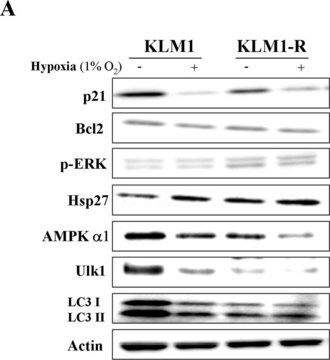 Anticuerpo anti-AMPK &#945;1 Upstate&#174;, from rabbit