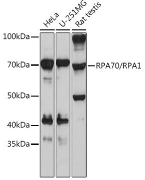 Przeciwciało anty-RPA70/RPA1, klon 5R7S3, królicze monoklonalne