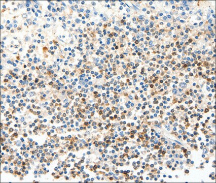 Anti-FAM3A antibody produced in rabbit affinity isolated antibody