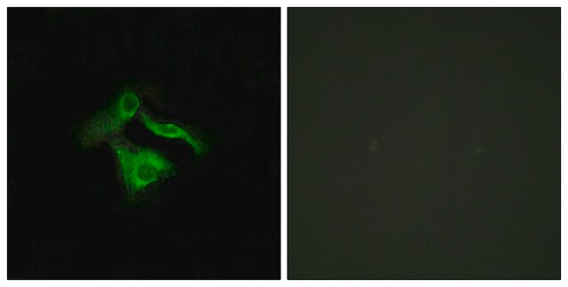 Anti-GPR149 antibody produced in rabbit affinity isolated antibody