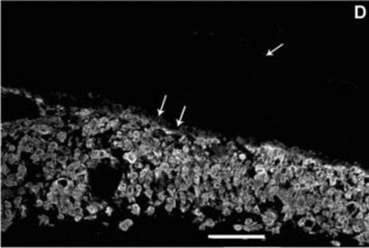 Monoclonal Anti-Cytokeratin Peptide 7 antibody produced in mouse clone LDS-68, ascites fluid