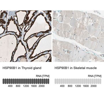 Anti-HSP90B1 antibody produced in rabbit Prestige Antibodies&#174; Powered by Atlas Antibodies, affinity isolated antibody, buffered aqueous glycerol solution