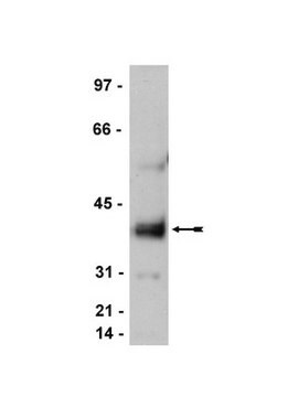 Anti-Stargazin/Cacng2 Antibody, CT Upstate&#174;, from rabbit