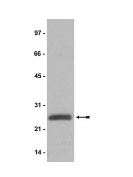 Anticorps anti-histone H2A ubiquitinylée, clone&nbsp;E6C5 clone E6C5, Upstate&#174;, from mouse