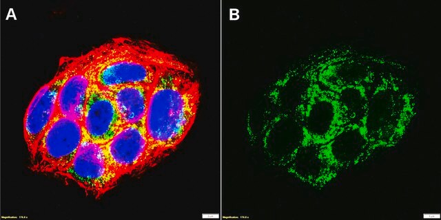 Przeciwciało anty-TGFβ receptor 1, klon 4H18 10889 Królik monoklonalny recombinant, expressed in HEK 293 cells