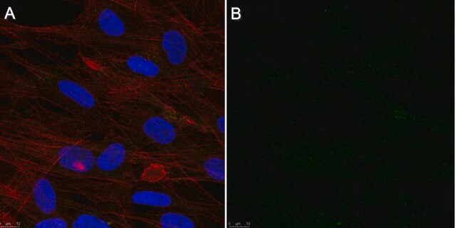 Anticorps anti-cytomégalovirus, clone&nbsp;8B1.2 clone 8B1.2, Chemicon&#174;, from mouse