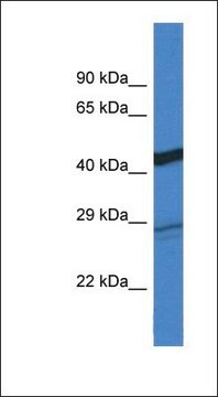 抗DGAT2抗体 ウサギ宿主抗体 affinity isolated antibody