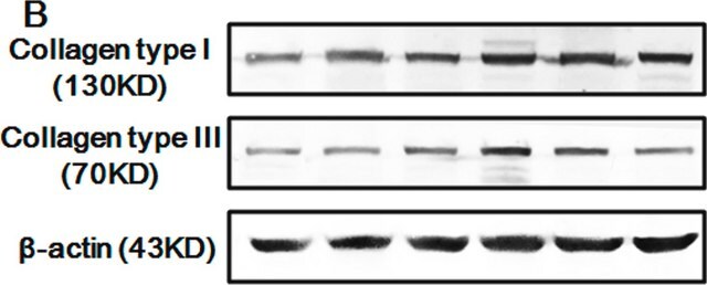 Anticorps monoclonal anti-collagène de type&nbsp;I antibody produced in mouse clone COL-1, ascites fluid