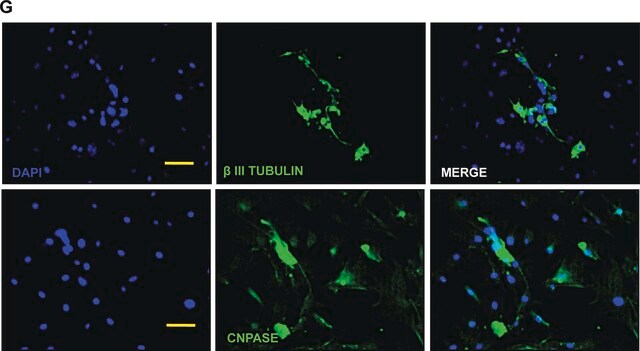 Anticorps anti-CNPase, clone&nbsp;11-5B clone 11-5B, Chemicon&#174;, from mouse