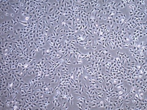 Humane TC28a2-Chondrozyten-Zelllinie TC28a2 Human Chondrocyte Cell Line is widely used as a model cell line for studying normal and pathological cartilage repair mechanisms related to chondrocyte biology and physiology.