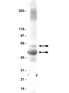 Anti-GABA&nbsp;A-Rezeptor&nbsp;&#946;2/3-Antikörper clone 62-3G1, Upstate&#174;, from mouse